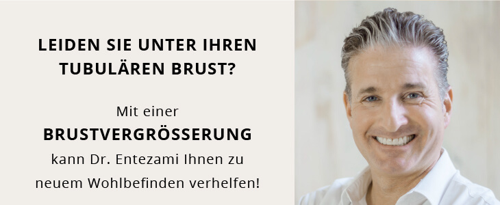 Tubuläre Brust Dr. Entezami Hannover 